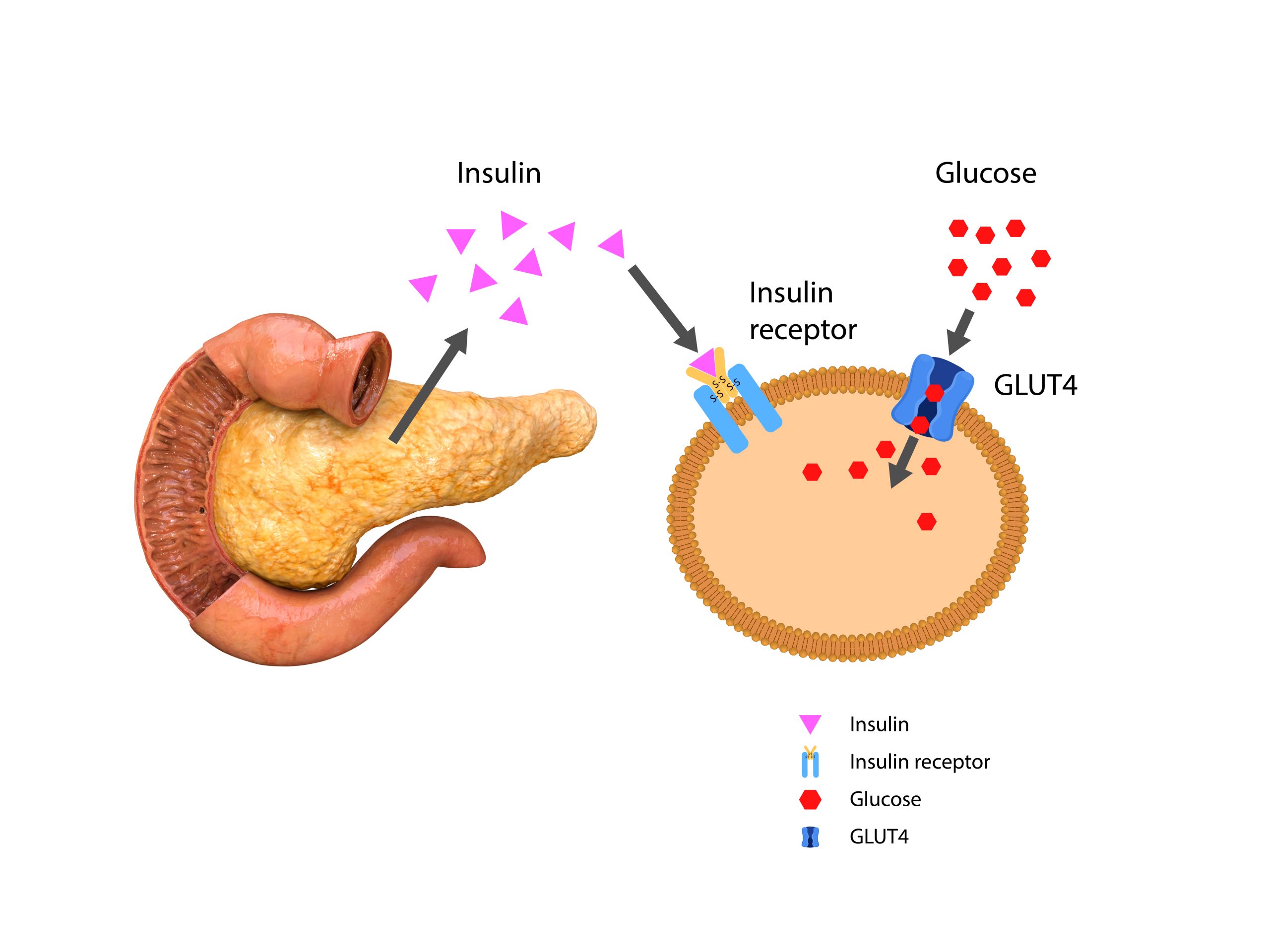 insulin-resistance